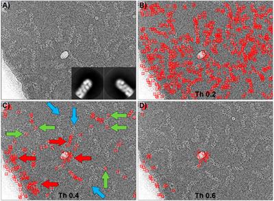 Semantic segmentation-based detection algorithm for challenging cryo-electron microscopy RNP samples